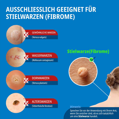 ANTI STIELWARZE