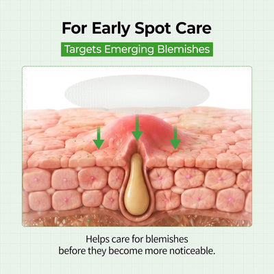 S-ZINC ZERO-FIT - Spot Patches