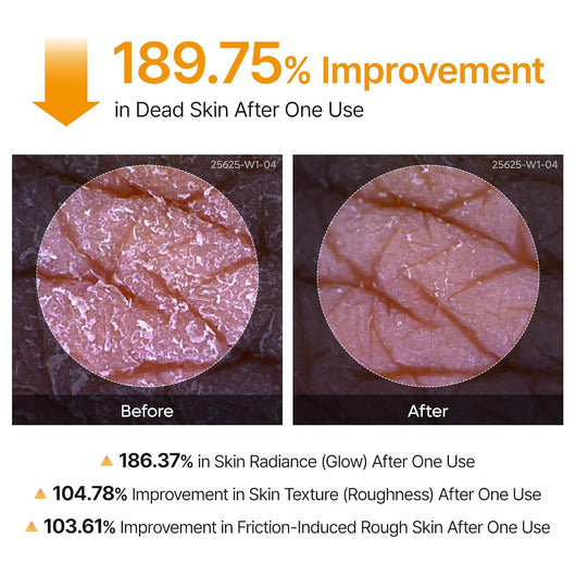 Body Peel Shot Spray