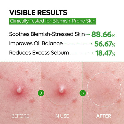 S-ZINC ZERO-FIT - Spot Patches