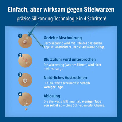 ANTI STIELWARZE