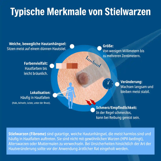ANTI STIELWARZE