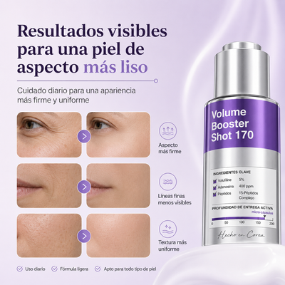 Inyección potenciadora de volumen 170